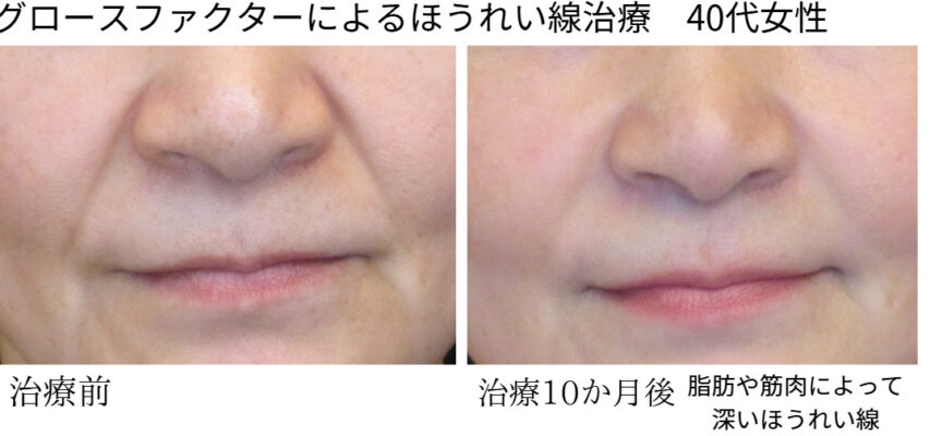 ビフォーアフター