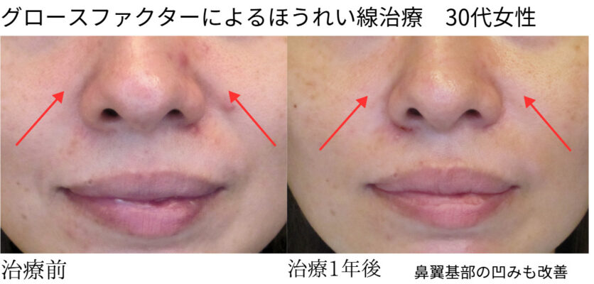 ビフォーアフター