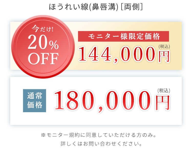 モニター価格 ほうれい線(鼻唇溝)［両側］144,000円（税込）通常価格180,000円 ※モニター規約に同意していただける方のみ。詳しくはお問い合わせください。