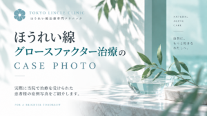 ほうれい線グロースファクター治療の症例写真